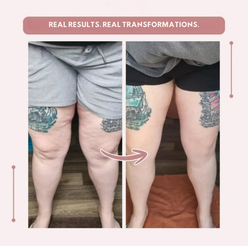 AquaLure™ — Swimwear That Shapes Confidence and Feels Like Freedom