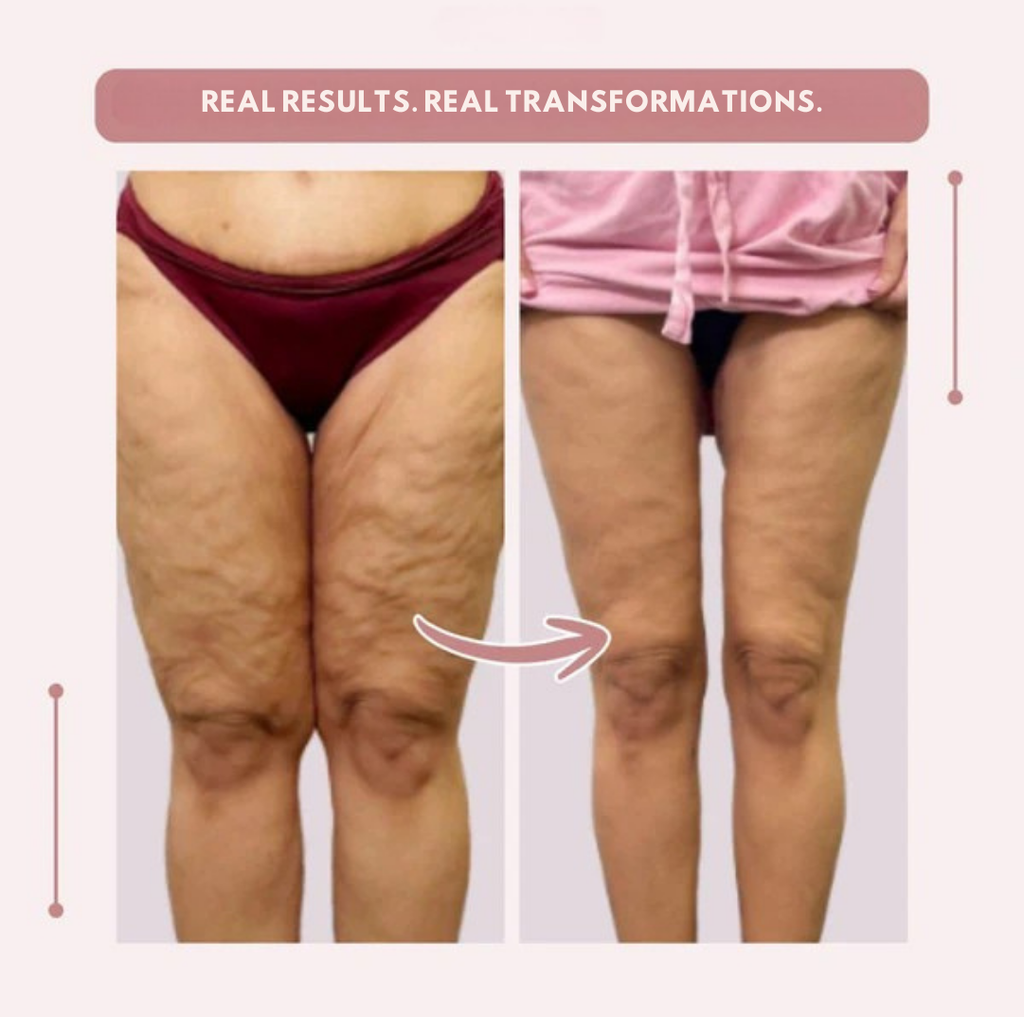 AquaLure™ — Swimwear That Shapes Confidence and Feels Like Freedom