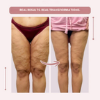 AquaLure™ — Swimwear That Shapes Confidence and Feels Like Freedom